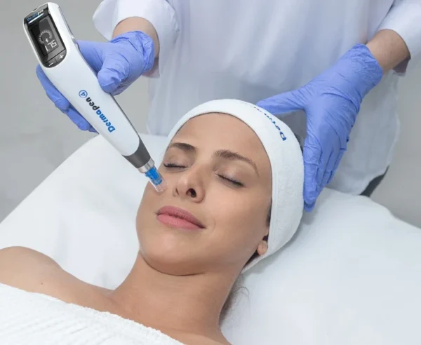 Achieve Optimal Microneedling Results with Dp4™